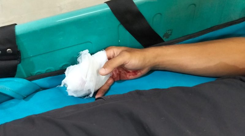 Pegawai BPBD Bandar Lampung Kehilangan 3 Jari Saat Evakuasi Banjir di Kedaton